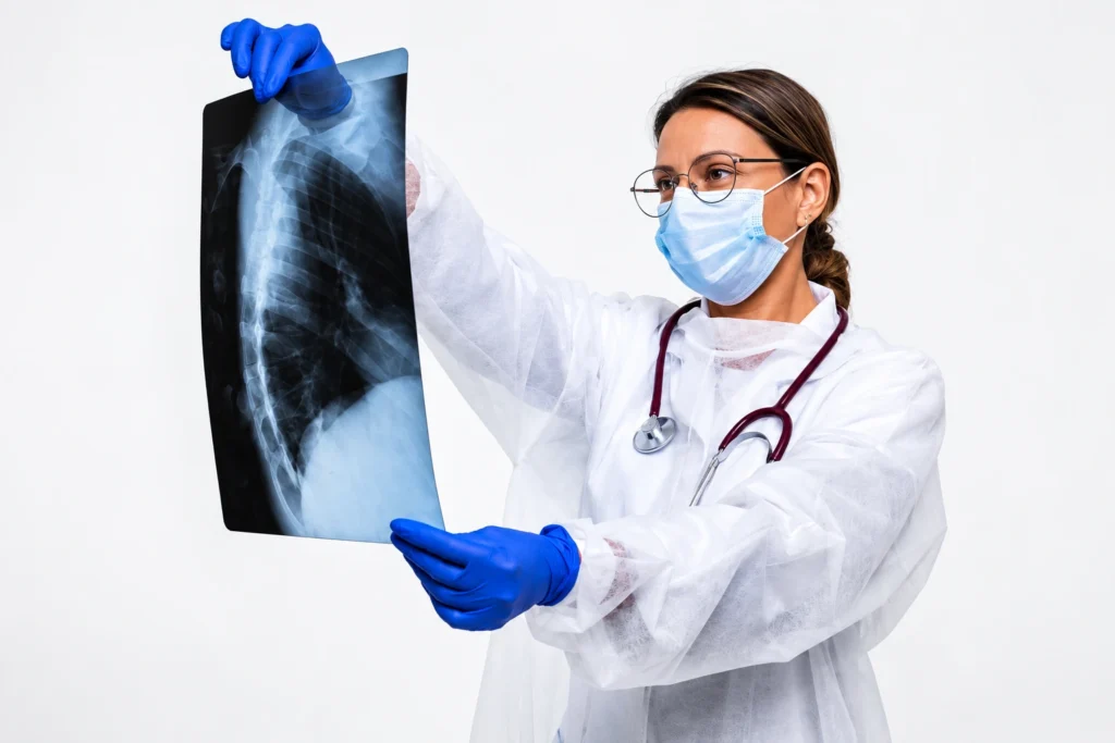 Doctor holding chest X-ray